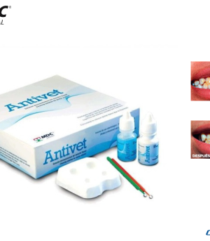 Antivet Kit Blanqueamiento Por Fluorosis MDC Web